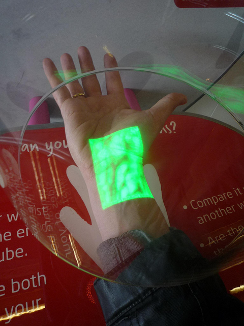 Vein Illumination Technology Makes Hard Sticks a Thing of the Past